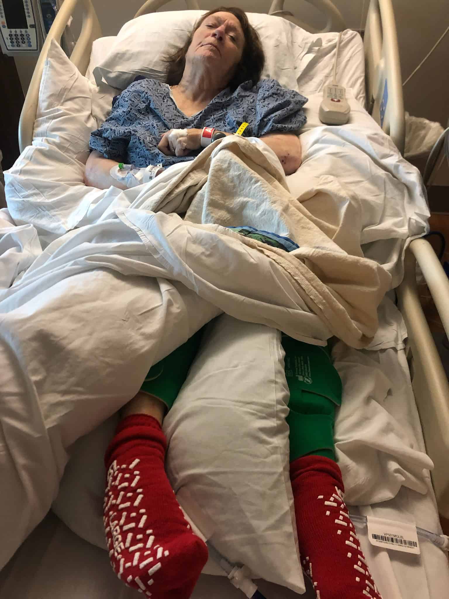 Elderly woman in hospital bed with medical tubes and red socks, resting after treatment.